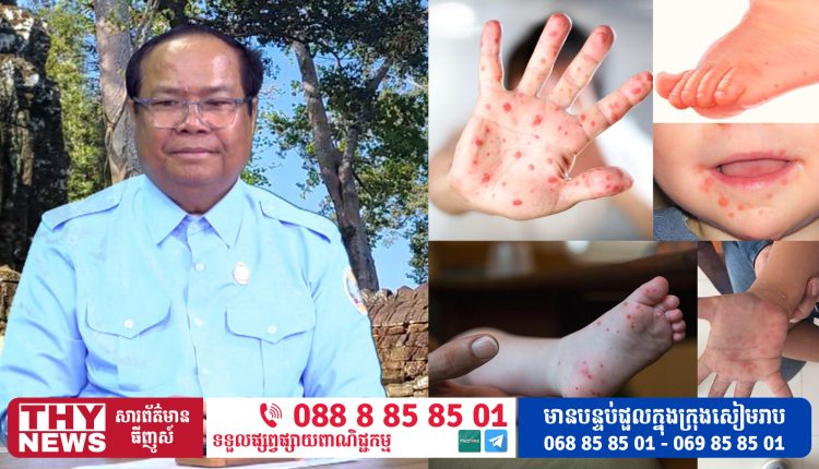 THY News 987